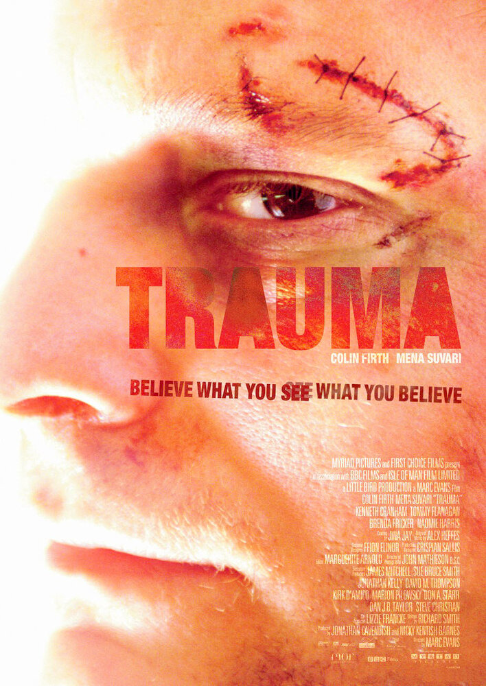 Trauma