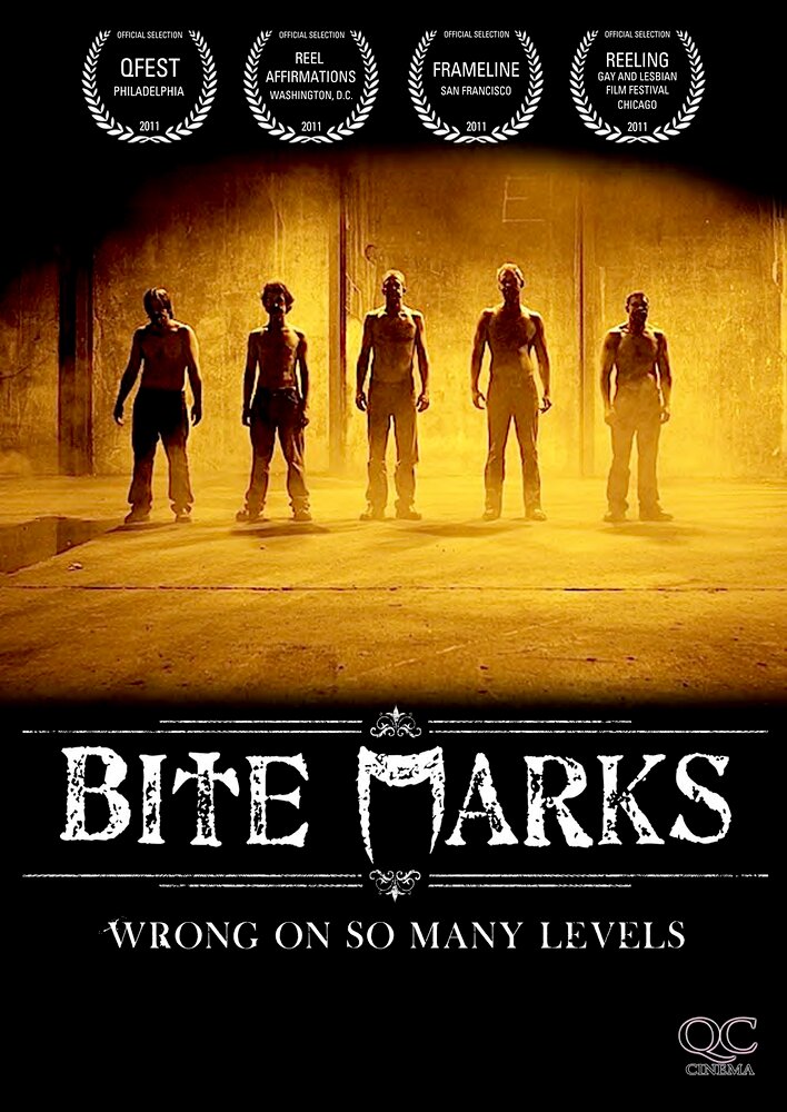 Bite Marks