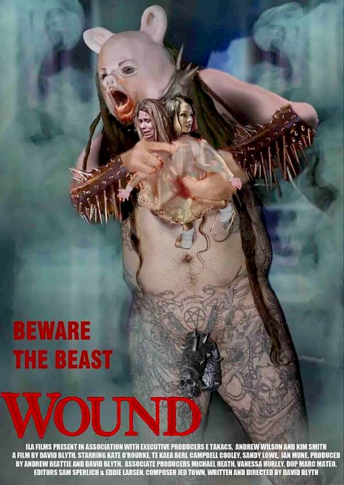 Wound