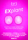 Explant