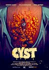 Cyst